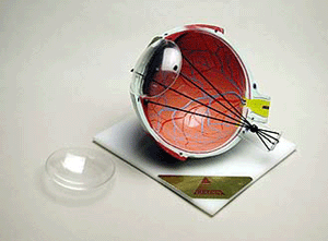 Astigmatism # 15123